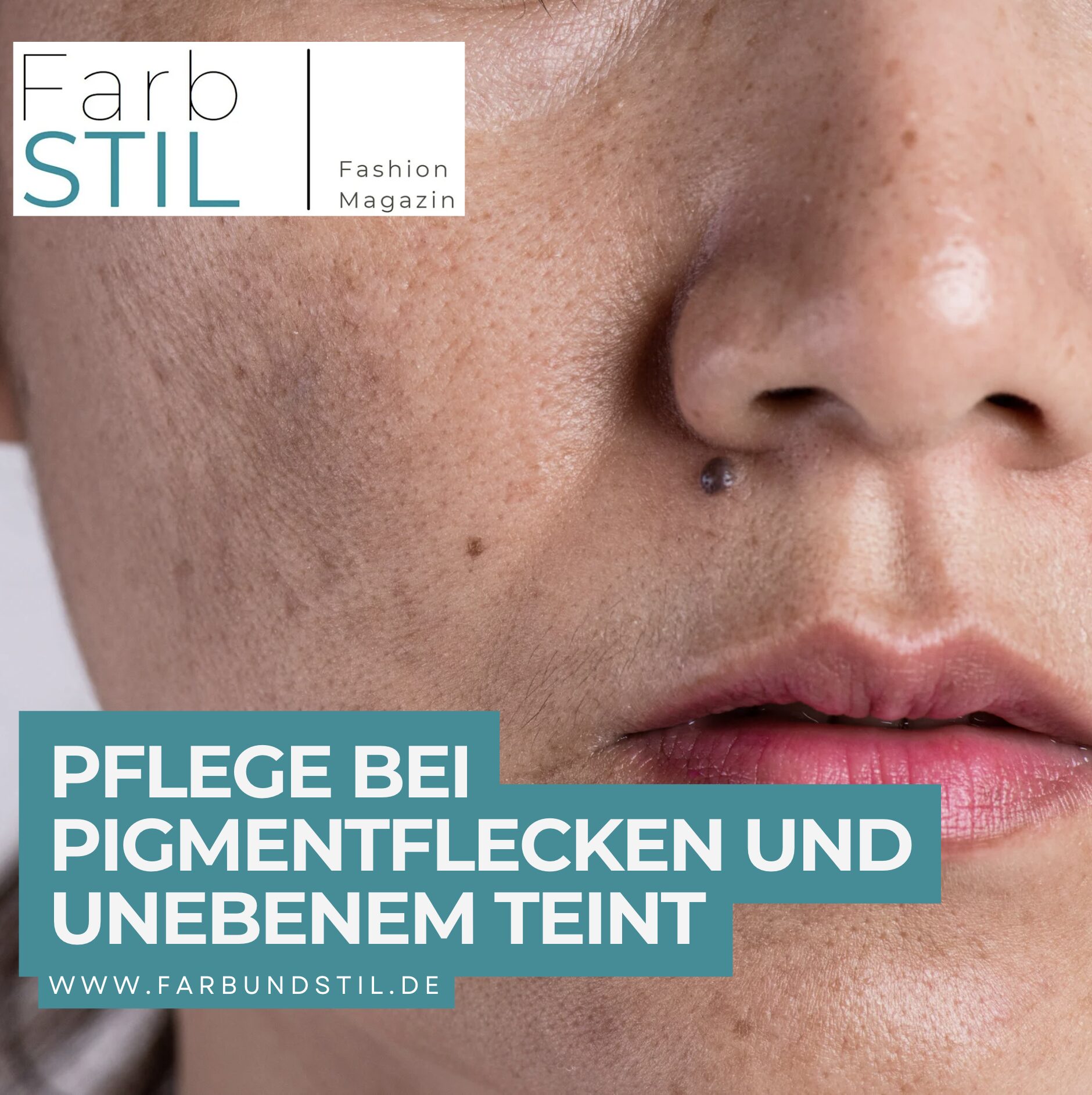 Pflege bei Pigmentflecken und unebenem Teint Pflege bei Pigmentflecken und unebenem Teint