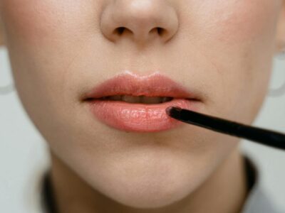 sonnenbrand auf den lippen