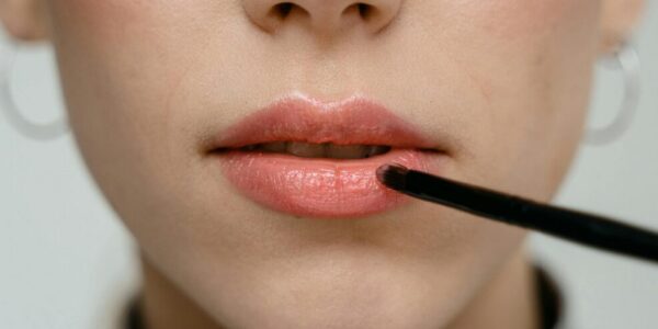 sonnenbrand auf den lippen