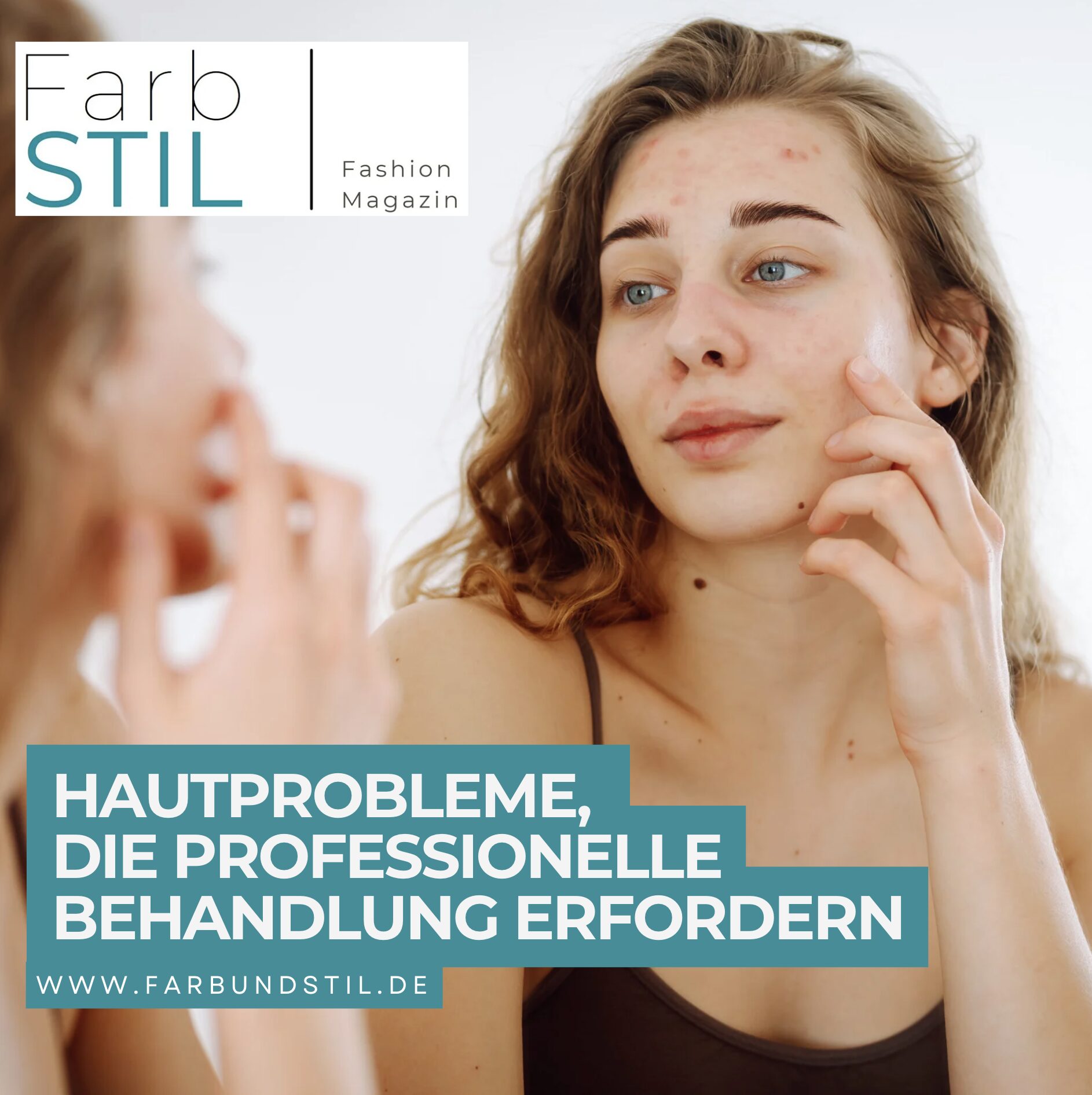 Hautprobleme, die professionelle Behandlung erfordern Hautprobleme, die professionelle Behandlung erfordern